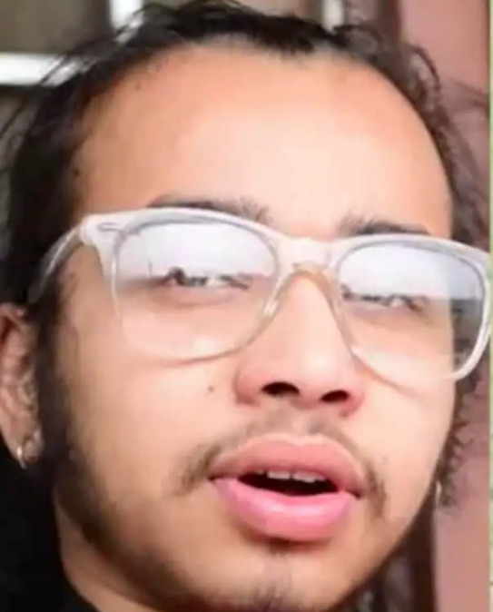 வால் போல் இளைஞரின் முதுகில் வளரும் முடி!