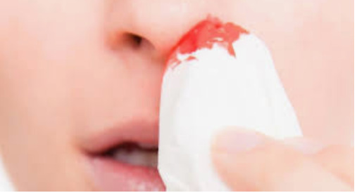 மர்ம காய்ச்சலால் மூக்கில் ரத்தம்.. உயிரிழப்பு! மக்கள் அச்சம்!