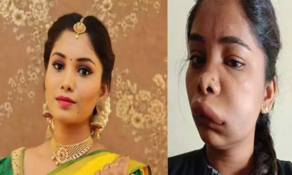 பல் வலிக்கு சிகிச்சை பெற்ற கன்னட நடிகை முகம் மாறி பரிதாப நிலை.. - Dhinasari Tamil